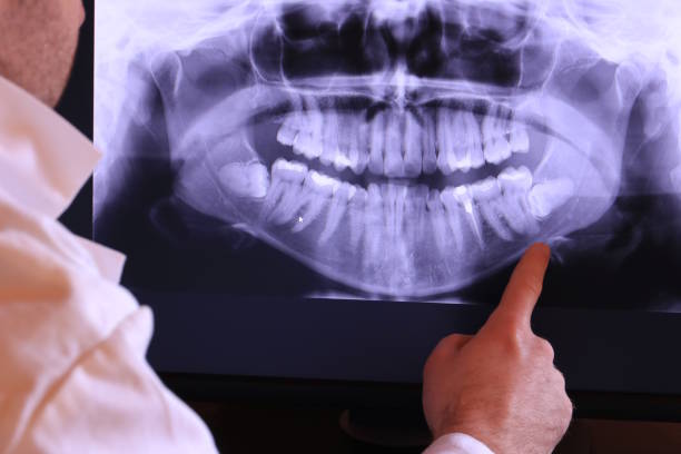Best Emergency Dental Extractions in Bandon, OR